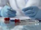 El brote de &eacute;bola en la RD del Congo mata a 65 personas y se registran 246 casos